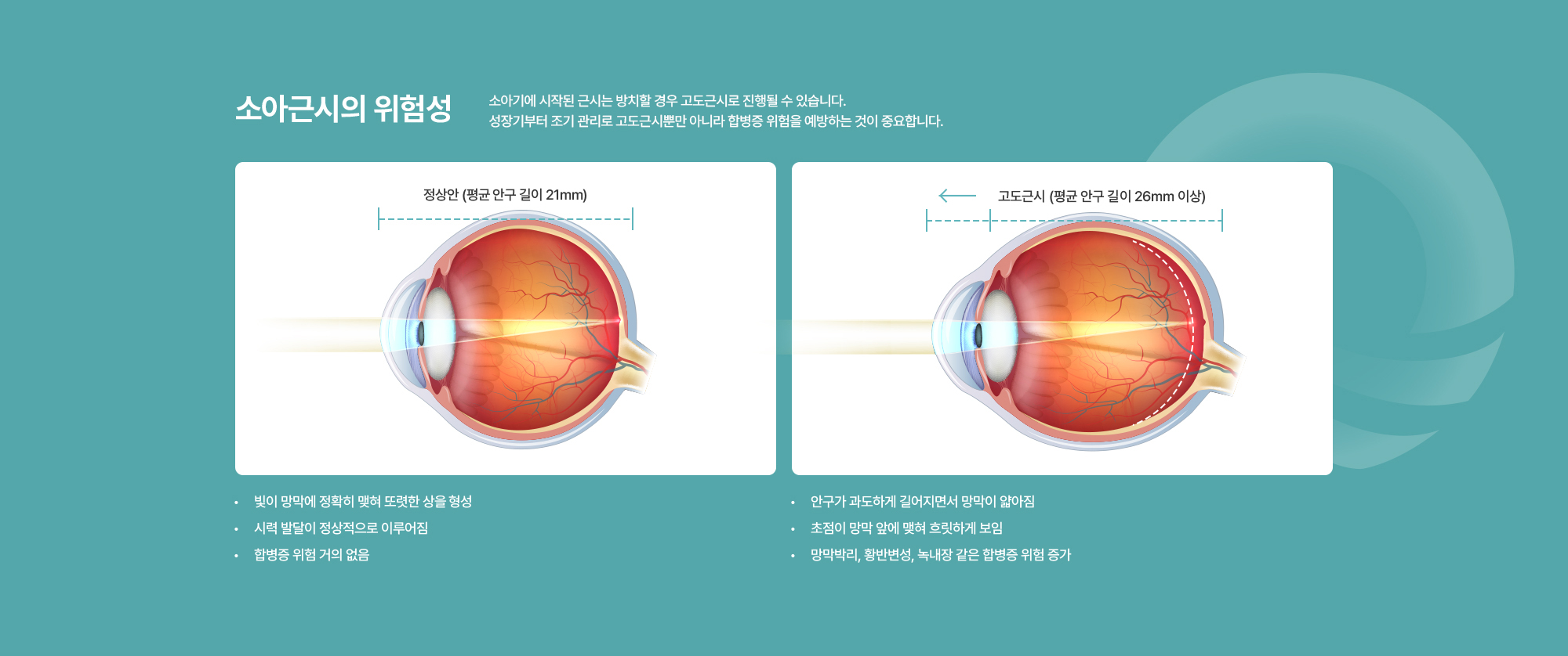 [소아근시의 위험성] 노안은 개인의 눈 상태와 생활 불편 정도에 따라 수술 시기가 달라집니다. 정밀 검사와 상담을 통해 가장 적절한 시점을 결정하는 것이 중요합니다.
