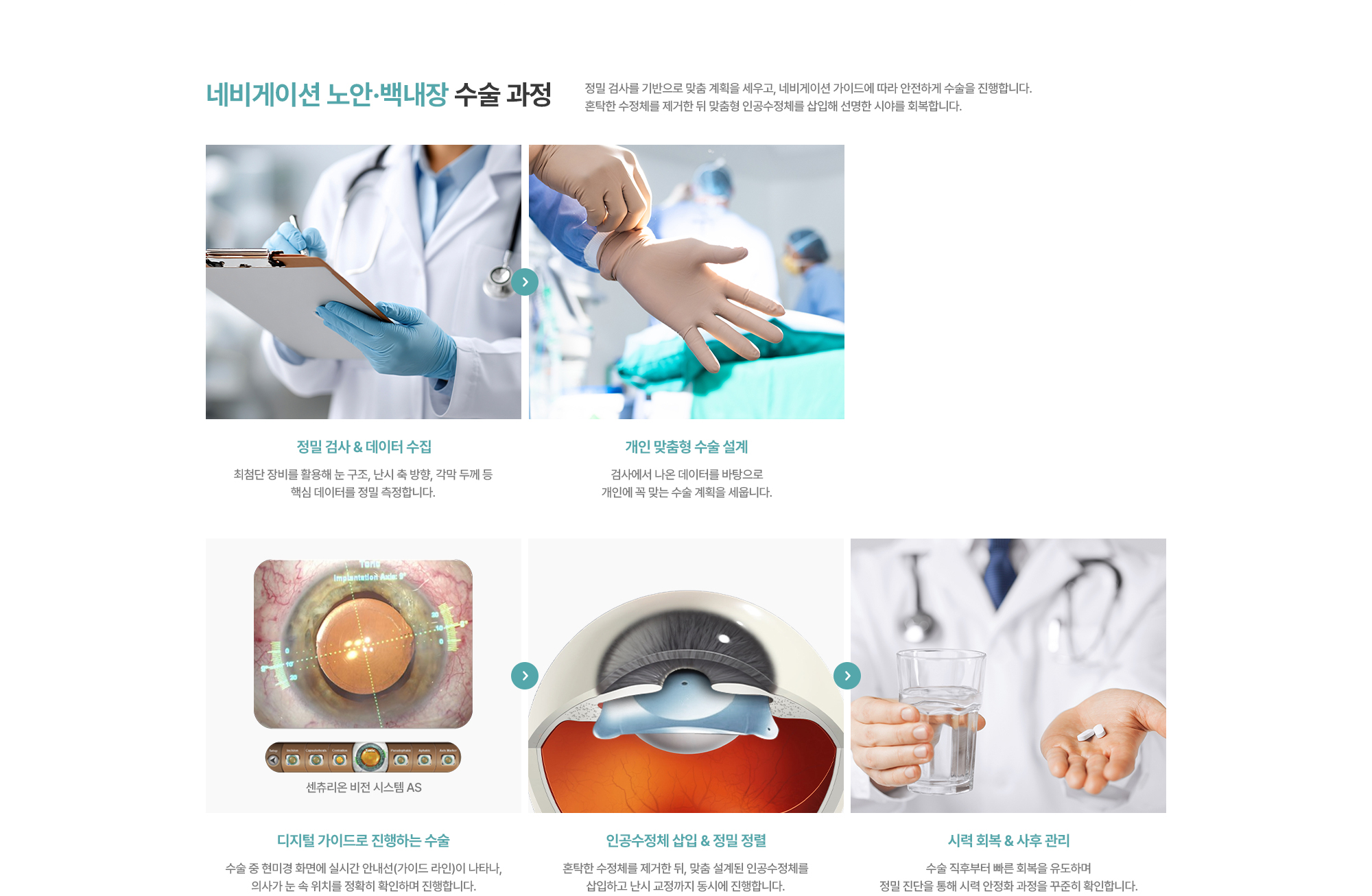 [네비게이션 노안·백내장 수술 과정] 정밀 검사를 기반으로 맞춤 계획을 세우고, 네비게이션 가이드에 따라 안전하게 수술을 진행합니다. 혼탁한 수정체를 제거한 뒤 맞춤형 인공수정체를 삽입해 선명한 시야를 회복합니다.