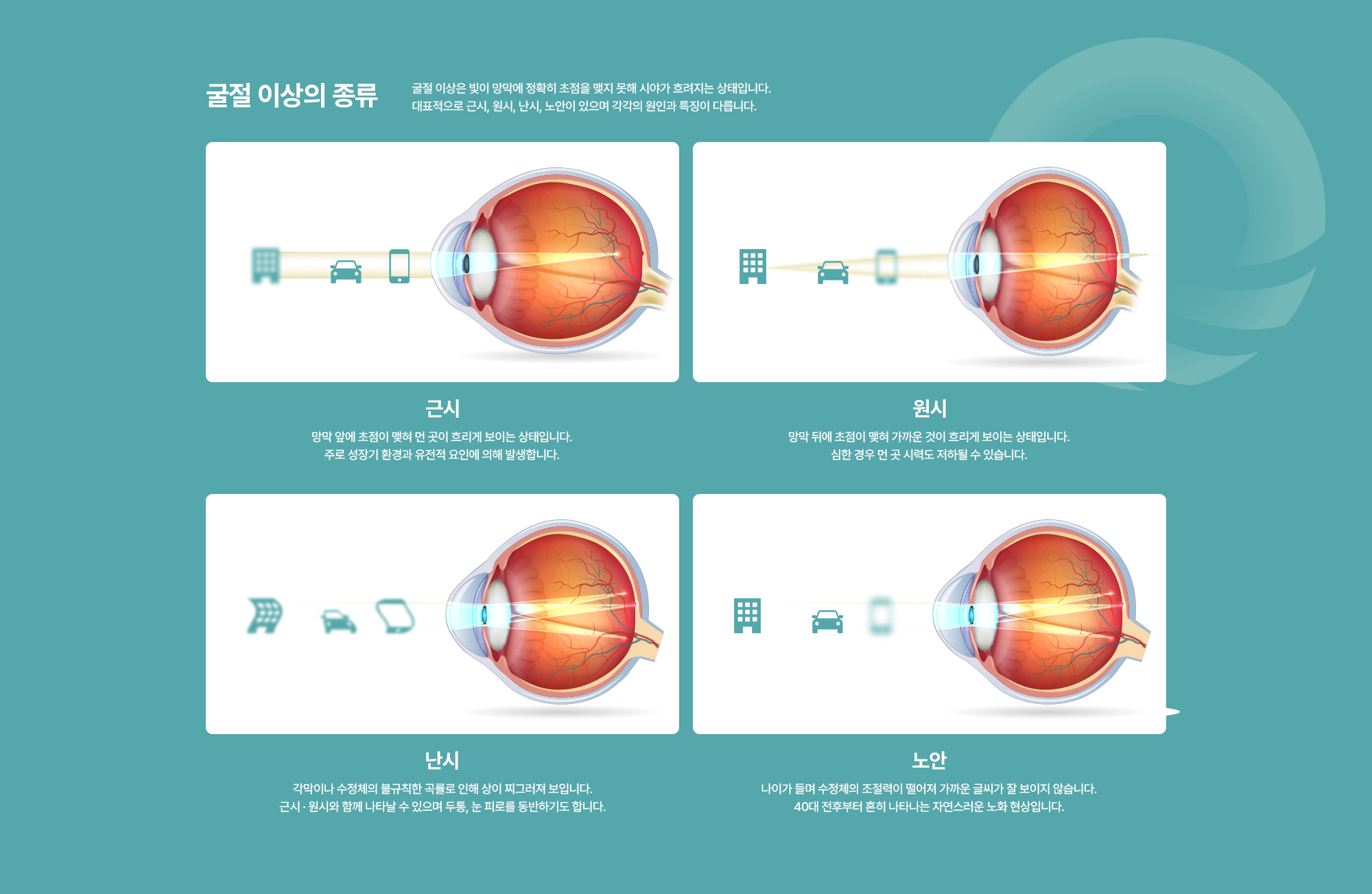 [굴절 이상의 종류] 굴절 이상은 빛이 망막에 정확히 초점을 맺지 못해 시야가 흐려지는 상태입니다. 대표적으로 근시, 원시, 난시, 노안이 있으며 각각의 원인과 특징이 다릅니다.