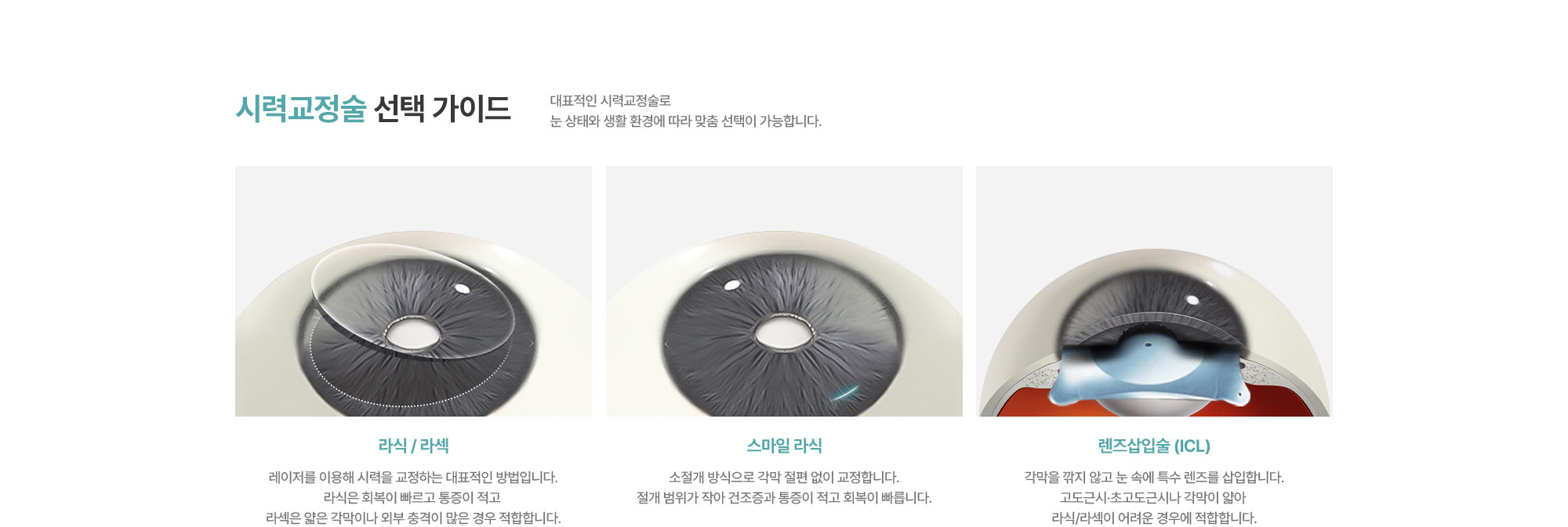 [시력교정술 선택 가이드] 라식 / 라섹 : 레이저를 이용해 시력을 교정하는 대표적인 방법입니다. 라식은 회복이 빠르고 통증이 적고 라섹은 얇은 각막이나 외부 충격이 많은 경우 적합합니다. / 스마일 라식 : 소절개 방식으로 각막 절편 없이 교정합니다. 절개 범위가 작아 건조증과 통증이 적고 회복이 빠릅니다. / 렌즈삽입술 (ICL) : 각막을 깎지 않고 눈 속에 특수 렌즈를 삽입합니다. 고도근시·초고도근시나 각막이 얇아 라식/라섹이 어려운 경우에 적합합니다.