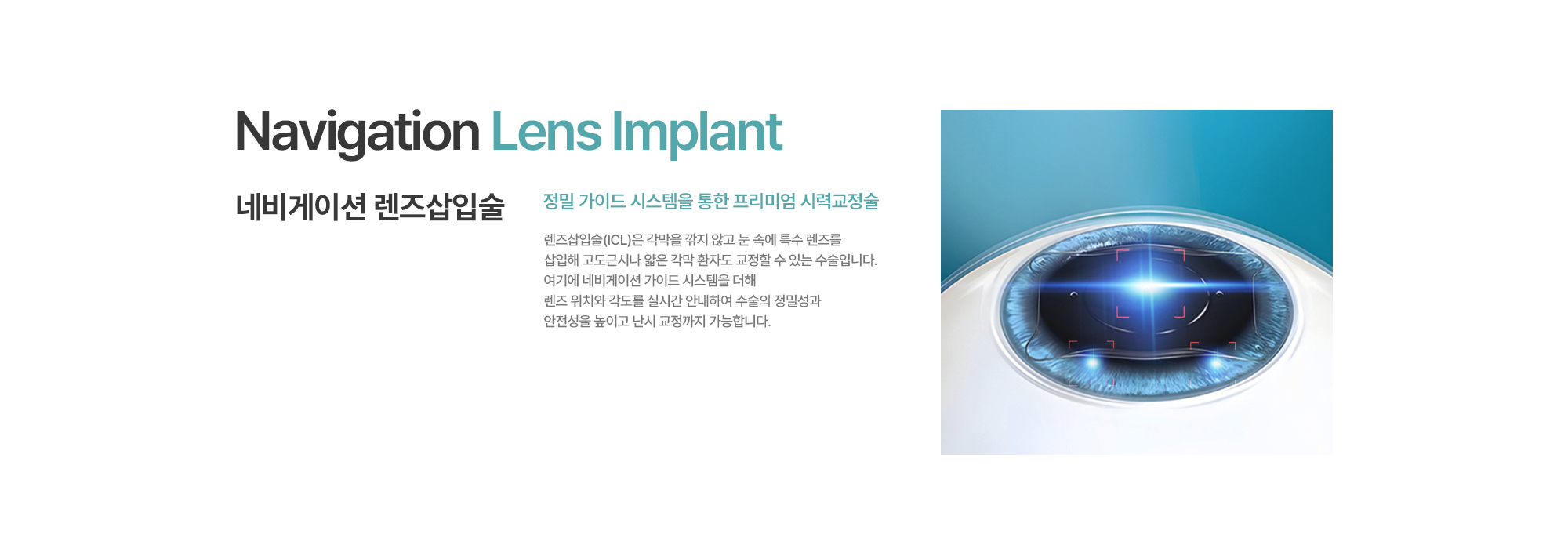 [네비게이션 렌즈삽입술] 정밀 가이드 시스템을 통한 프리미엄 시력교정술. 렌즈삽입술(ICL)은 각막을 깎지 않고 눈 속에 특수 렌즈를 삽입해 고도근시나 얇은 각막 환자도 교정할 수 있는 수술입니다. 여기에 네비게이션 가이드 시스템을 더해 렌즈 위치와 각도를 실시간 안내하여 수술의 정밀성과 안전성을 높이고 난시 교정까지 가능합니다.