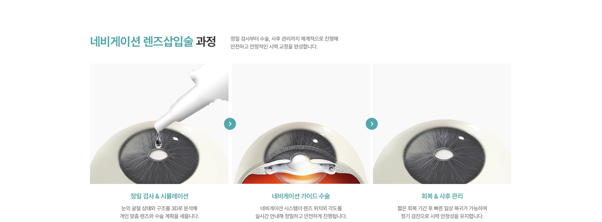[네비게이션 렌즈삽입술 과정] 정밀 검사 & 시뮬레이션 > 네비게이션 가이드 수술 > 회복 & 사후 관리