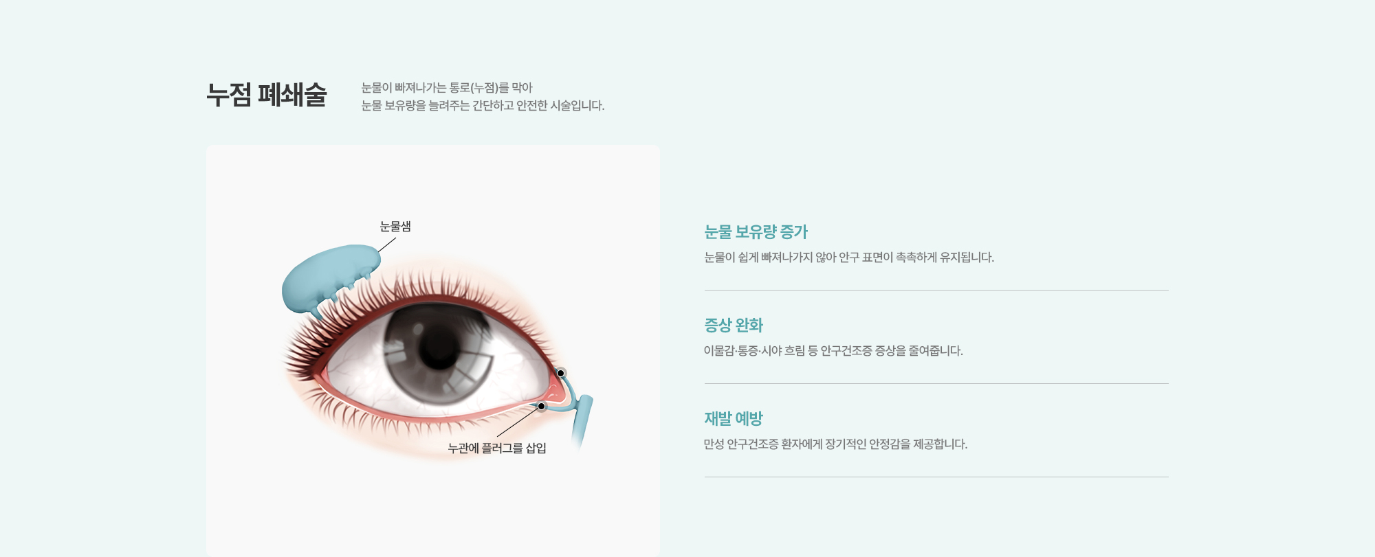 [누점 폐쇄술] 눈물이 빠져나가는 통로(누점)를 막아 눈물 보유량을 늘려주는 간단하고 안전한 시술입니다.