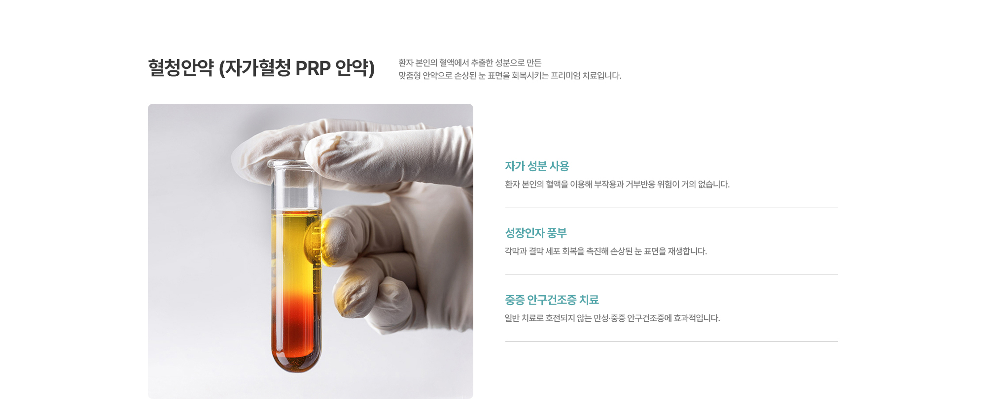 [혈청안약 (자가혈청 PRP 안약)] 환자 본인의 혈액에서 추출한 성분으로 만든 맞춤형 안약으로 손상된 눈 표면을 회복시키는 프리미엄 치료입니다.