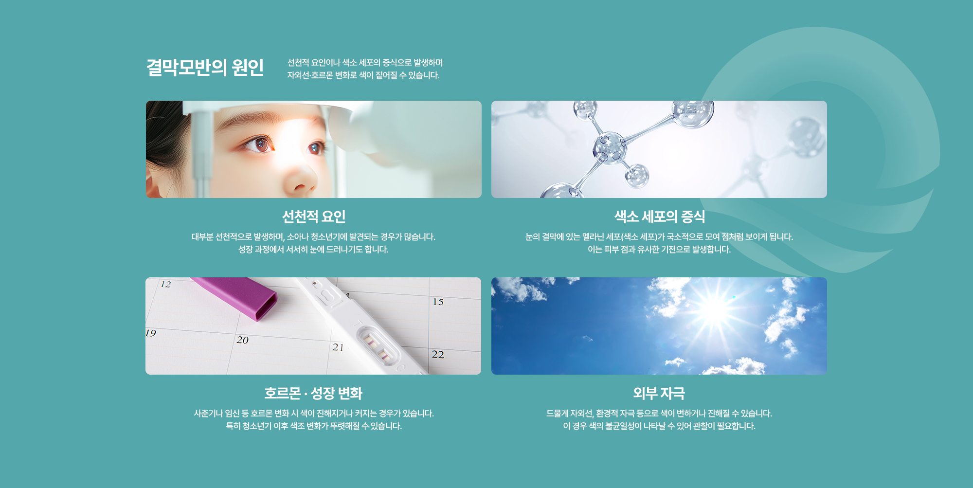 [결막모반의 원인] 선천적 요인 / 색소 세포의 증식 / 호르몬 · 성장 변화 / 외부 자극